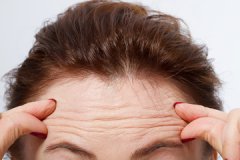 有抬頭紋怎么辦?怎樣去除抬頭紋