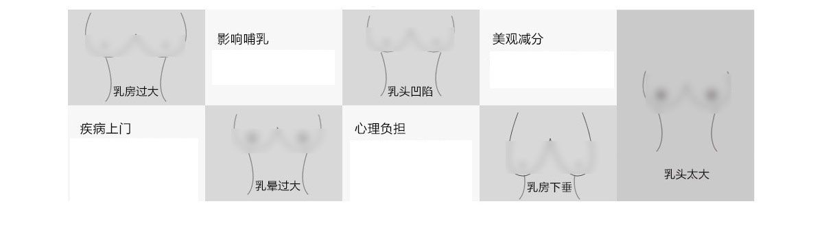 胸部整形常見問(wèn)題