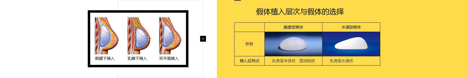 陽(yáng)光假體胸部定制